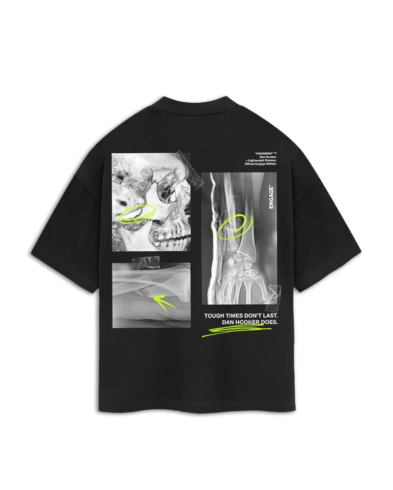 Dan Hooker 'Just a Scratch' Oversized Supporter T-Shirt - Image 4